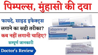 Adapalene Gel Uses Side Effects Review in Hindi  How to Apply Adapalene Gel  Pimples Ki Cream [upl. by Saunderson]