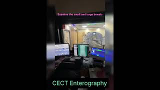 CT Scan Enterography [upl. by Steffie]