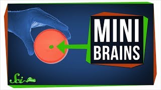 What Growing Mini Brains Has Taught Us And Whats Next [upl. by Cung531]