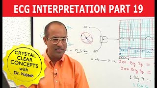 EKG or ECG Interpretation  Part 1920 [upl. by Osmen]