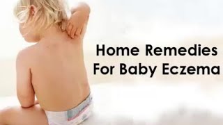 How to Get Rid of Eczema  Home Remedies For Baby Eczema [upl. by Llabmik]