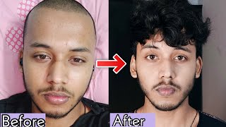 How To Correct Facial Asymmetry  How To Fix Asymmetrical Face  Fixing Uneven Jaw [upl. by Akirej]