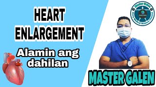 HEART ENLARGEMENT o CARDIOMEGALY Bakit nagkakaroon nito at paano ito maiiwasan [upl. by Ahseet28]