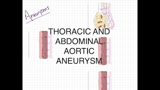 Pathophysiology of Aortic Aneurysms [upl. by Ynnob16]