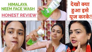 HIMALAYA NEEM FACE WASH  Honest review on Himalaya purifying neem face wash  Acne Pimples Problem [upl. by Adelaida452]