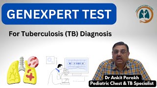 GeneXpert or CB NAAT test for Diagnosis of Tuberculosis I Dr Ankit Parakh Child TB Specialist [upl. by Nirre]