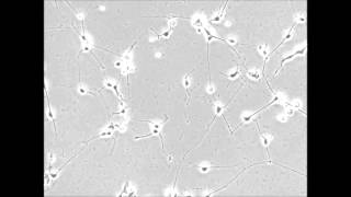 Differentiation of human ESCs to retinal ganglion cells using a CRISPR engineered reporter cell line [upl. by Anelegna]