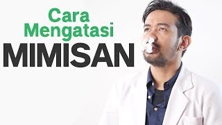 Cara Mengatasi Mimisan dengan Cepat   Tanya Dokter [upl. by Ariem]