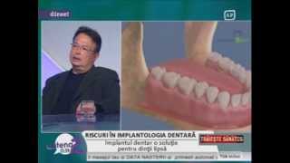 Riscuri in implantologia dentarawmv [upl. by Aicram]