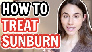 7 TIPS TO TREAT A SUNBURN 😳 Dermatologist DrDrayzday [upl. by Anifad]