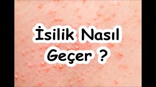 İsilik Nasıl Geçer [upl. by Uos242]