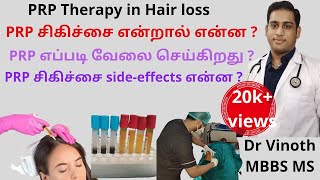 PRP therapy in Tamil  How PRP works in Hair loss   How PRP is made   Sideeffects Dr Vinoth [upl. by Tharp440]