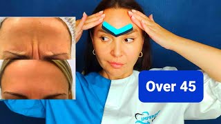 EFFECTIVE Way TO GET RID OF Wrinkles between eyebrows  How to get rid of FROWN LINES naturally [upl. by Filbert]