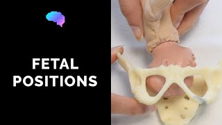 Types of Fetal Positions  OSCE Guide  UKMLA  CPSA [upl. by Winifield]