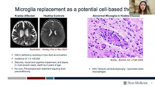 Sonia Lombroso Engineering an inhibitorresistant human CSF1R variant for microglia replacement [upl. by Ylas]