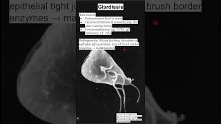 Giardiasis [upl. by Sallie]