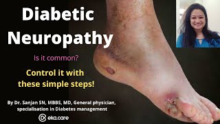 Diabetic Neuropathy foot pain Symptoms Causes Treatment amp Control [upl. by Dreeda]