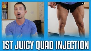 My First Quad Injection Experience [upl. by Nilerual]