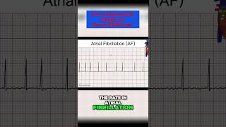 Atrial Fibrillation Causes Symptoms and Treatments  Explained by a Medical Professional [upl. by Pestana]