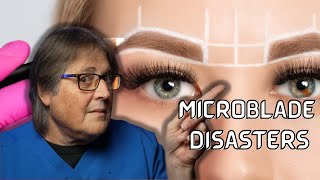 Before Removing Microblade Eyebrows With Lasers Watch This  A Doctor Explains [upl. by Leumhs555]