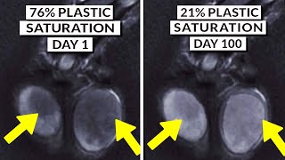 We Finally Know How To Detox Microplastics From The Body [upl. by Trinl935]