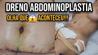 GUIA COMPLETO DRENO ABDOMINOPLASTIA Dicas Como usar e desentupir dreno pós operatório [upl. by Hardej19]