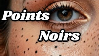 Points noirs acné visage astuce Naturelle pour les enlever extraction Boutons dacné du Nez [upl. by Christyna]