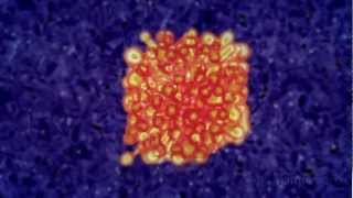 Immunotherapy Boosting the immune system to fight cancer [upl. by Eenahs]