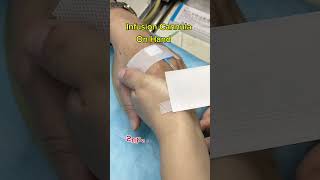 Infusion Cannula On Hand medical reels cannula shorts youtubeshorts [upl. by Aeikan]