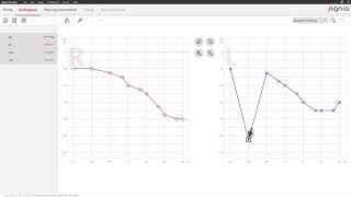 Enter an audiogram in Connexx 9  Signia Hearing Aids [upl. by Akkina]