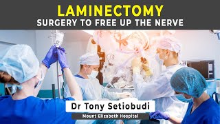 LAMINECTOMY  SURGERY FOR SPINAL STENOSIS [upl. by Marih]