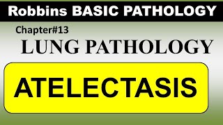 Chp13 Robbins Patho  Lung Pathology  ATELECTASIS [upl. by Arimihc]