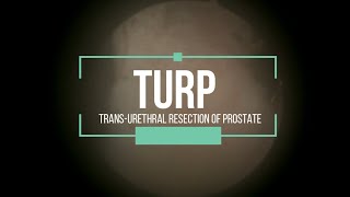 TURP  Transurethral Resection of Prostate [upl. by Uhej406]