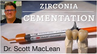 Zirconia Cementation with RelyX Universal Cement  Dr Scott MacLean  Dentist [upl. by Jervis]