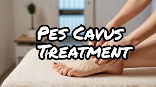 The TRUTH About Treating Pes Cavus High Arches [upl. by Gierc]