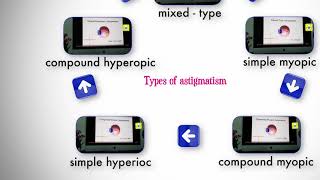 Types of astigmatism [upl. by Rora]