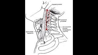 Tubercle of chassaignac or the Carotid tubercle of the 6th cervical vertebrae and its clinical relev [upl. by Siulesoj573]