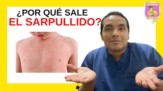 🔴 SABÍAS  ¿Por qué sale el SARPULLIDO  Dr Elmer H Luna Vilchez [upl. by Eissat510]