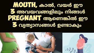 3 Early Pregnancy Symptoms Deechus world Malayalam [upl. by Eilliw]