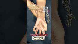 Nerve Palpation technique for upper limb radial nerve ulnar nerve median nerve [upl. by Thane124]