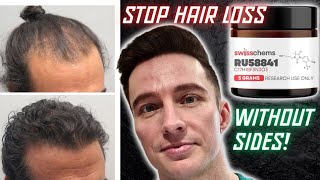 Why RU58841 is in My Hair Loss Protocol 2024 [upl. by Hamid30]