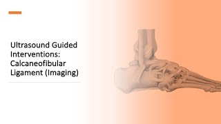 Ankle CFL Imaging [upl. by Albright15]