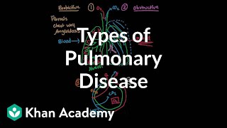 Types of pulmonary diseases  Respiratory system diseases  NCLEXRN  Khan Academy [upl. by Kohl719]