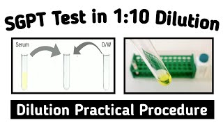 How to make 110 dilution for biochemistry Test  SGPT Test in Dilution [upl. by Meggi202]