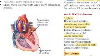 Medicine 156 Aortic Regurgitation Austin Flint Early Diastolic Murmur Water Hammer Pulse collapsing [upl. by Naret]