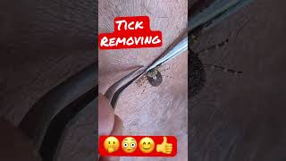 Wood tick removaltick 🤗😘 [upl. by Jamaal]