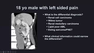 Case Review of Abdominal Imaging  Course Sample [upl. by Ahselaf584]