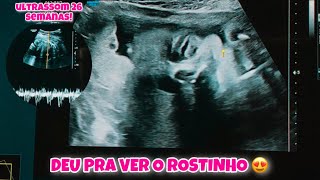 ULTRASSOM 26 SEMANAS  Deu pra ver o rostinho 🥰🤰🏻 [upl. by Hedwiga453]