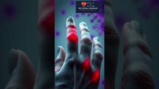 Rheumatoid Arthritis Explained Simply [upl. by Wailoo193]