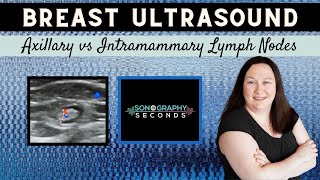 Breast Ultrasound Axillary vs Intramammary Lymph Nodes [upl. by Michail847]